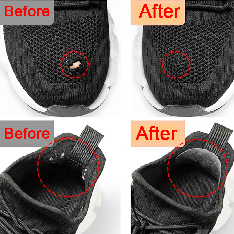 Parches para Calzado Deportivo - Sneaker Shoe Care Kit reseña y precio